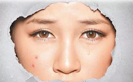 去口臭爆珠糖有用吗_口臭糖有用吗_口气爆珠糖有什么危害