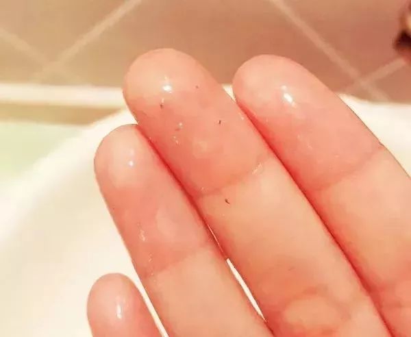 去口臭爆珠糖有用吗_口气爆珠糖有什么危害_口臭糖有用吗