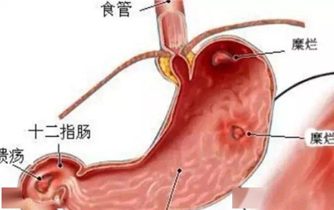 香口爆珠丸和口香糖区别_爆珠口香丸 有用吗_口香爆珠丸食用方法